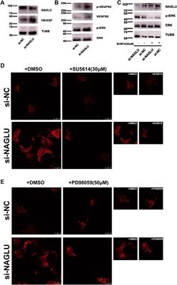 Downregulation of NAGLU in VEC Increases Abnormal Accumulation of Lysosomes and Represents a Predictive Biomarker in Early Atherosclerosis